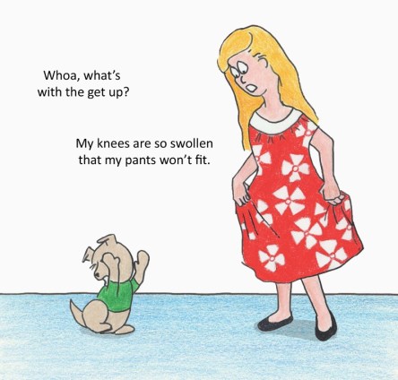 Whoa, what's with the get up? My knees are so swollen that my pants won't fit.